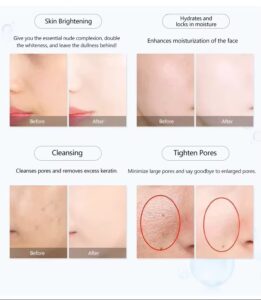 Electroporation Devicefunctions